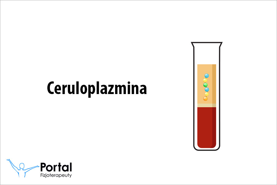 Ceruloplazmina