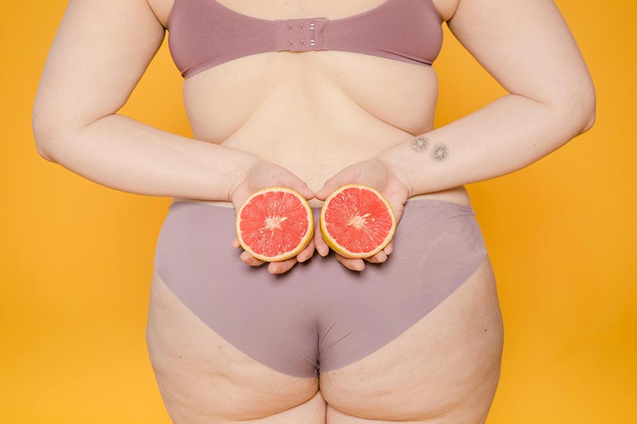 Co naprawdę działa na cellulit? TOP 5 zabiegów