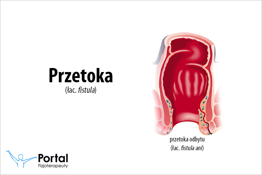 Przetoka