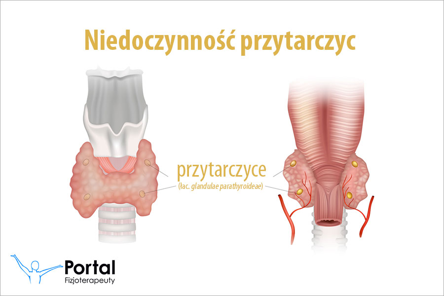 Niedoczynność przytarczyc